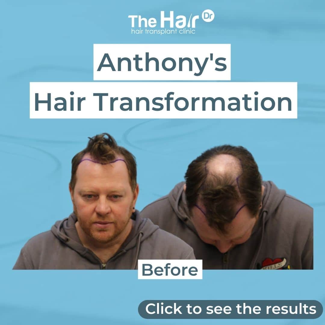 Patient transformation slide 1