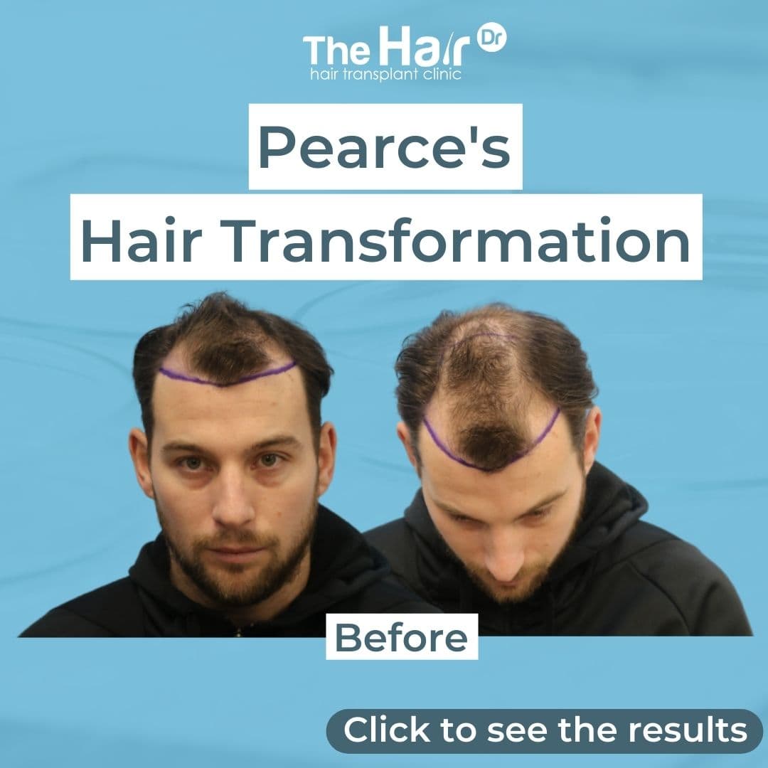 Patient transformation slide 1