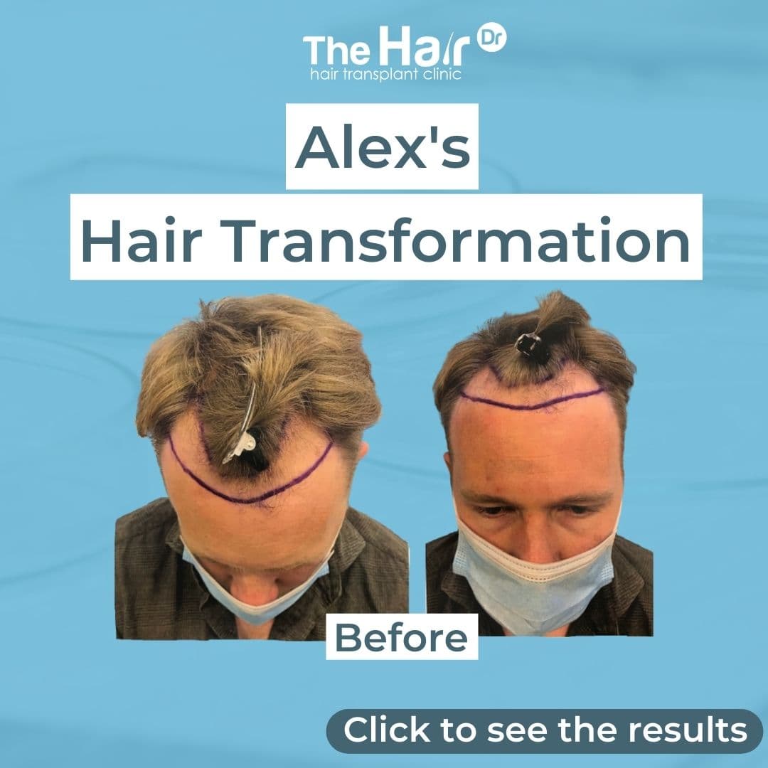 Patient transformation slide 1