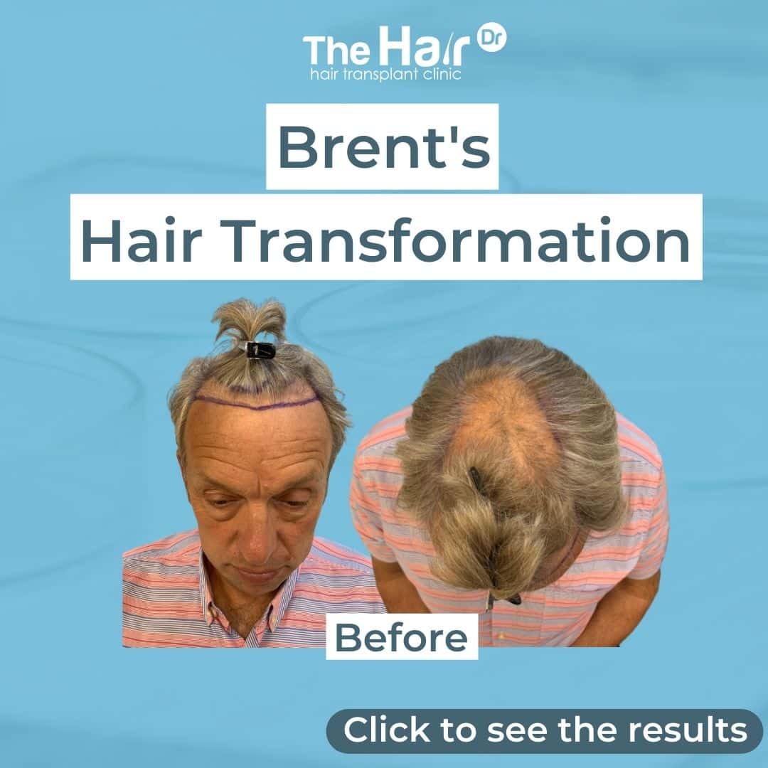 Patient transformation slide 1