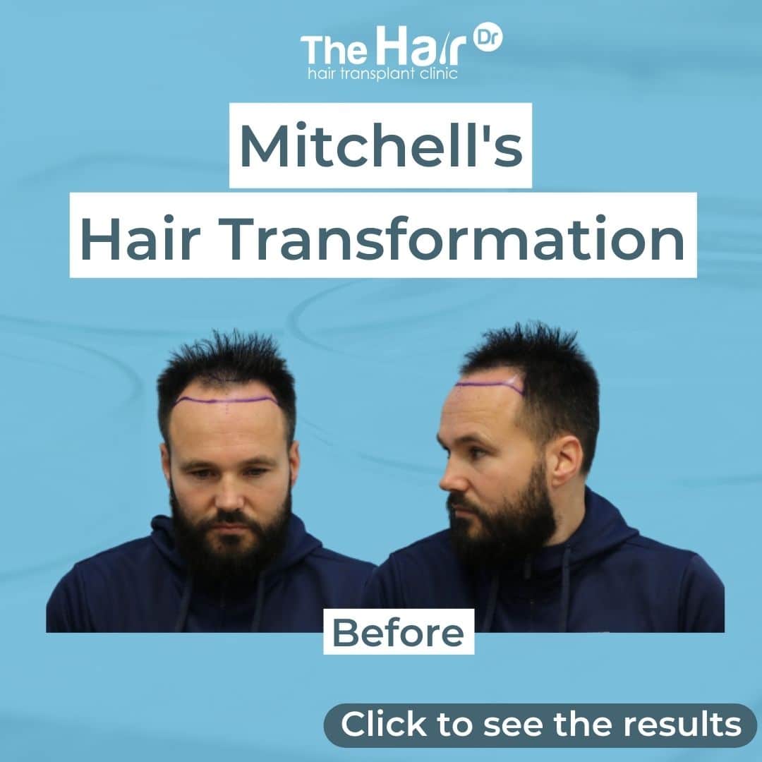 Patient transformation slide 1