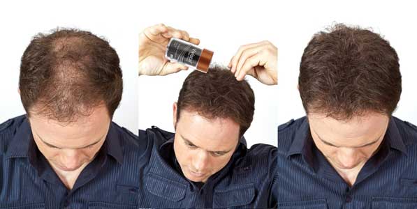 Hair Loss Fibres
