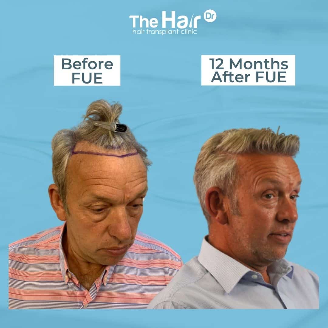 Patient transformation slide 3