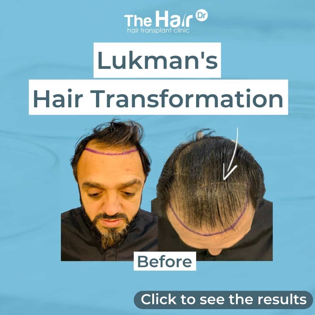 Patient transformation slide 1