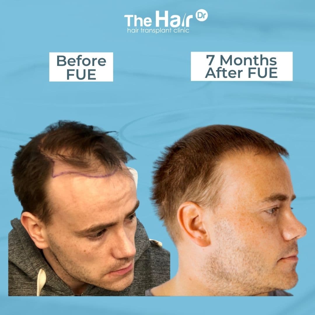 Patient transformation slide 3