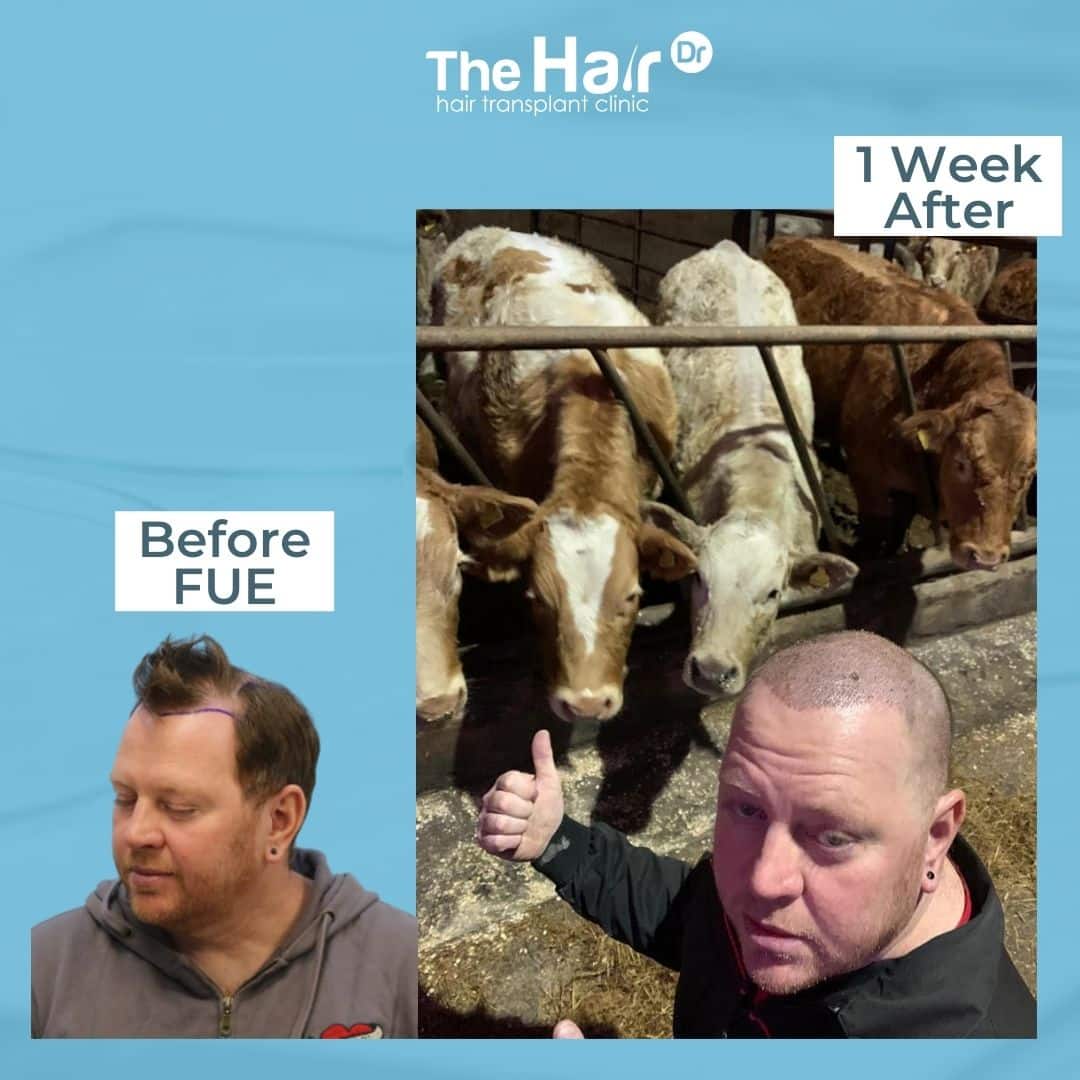 Patient transformation slide 3
