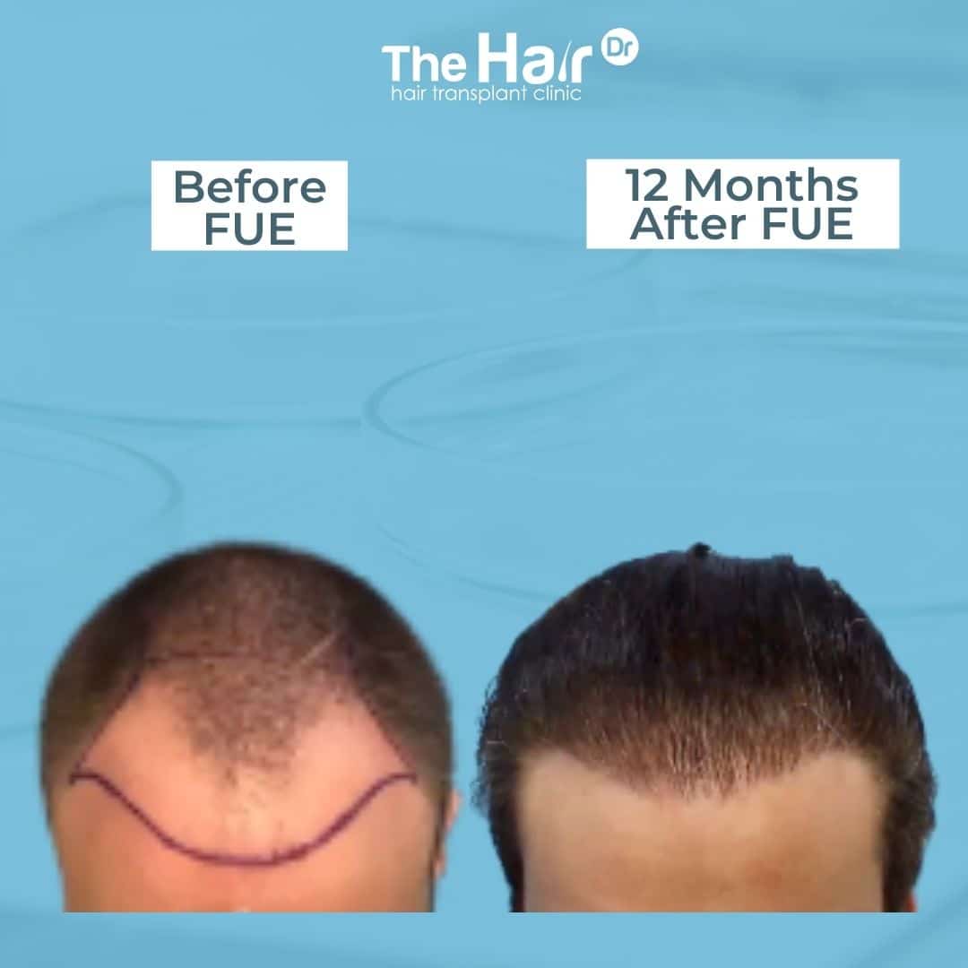 Patient transformation slide 7