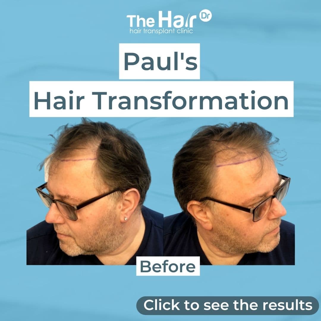 Patient transformation slide 1