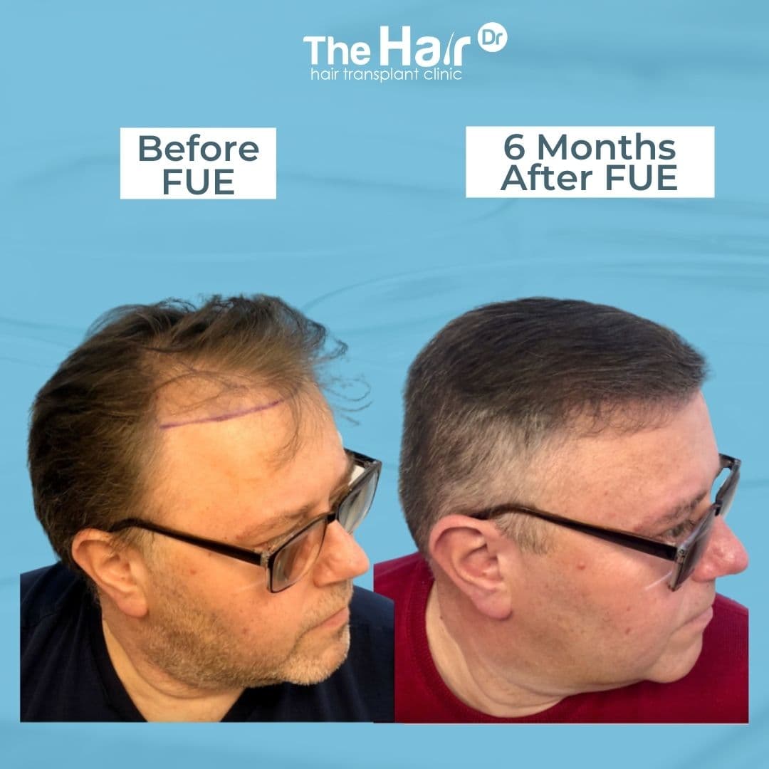 Patient transformation slide 2