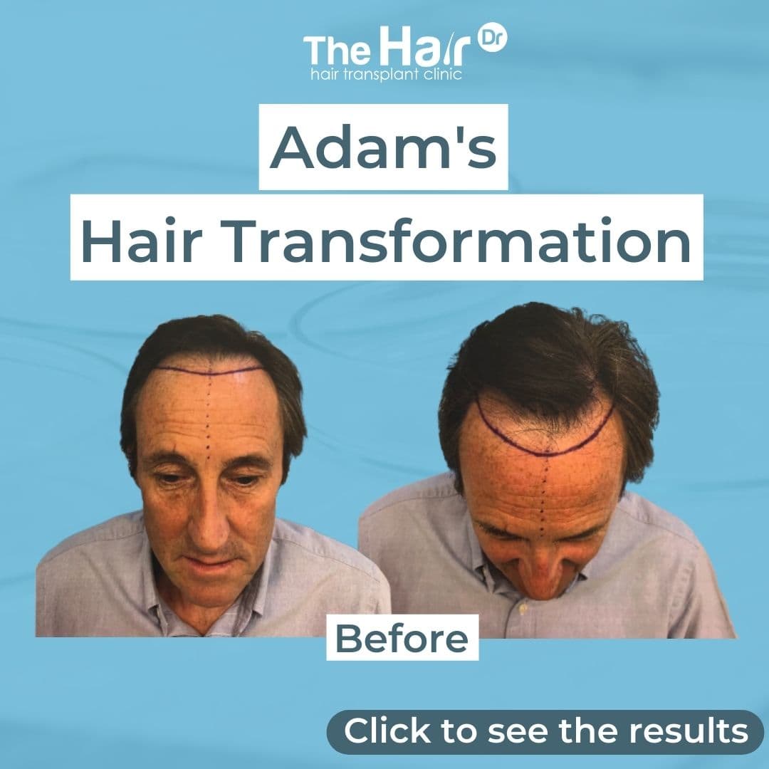 Patient transformation slide 1