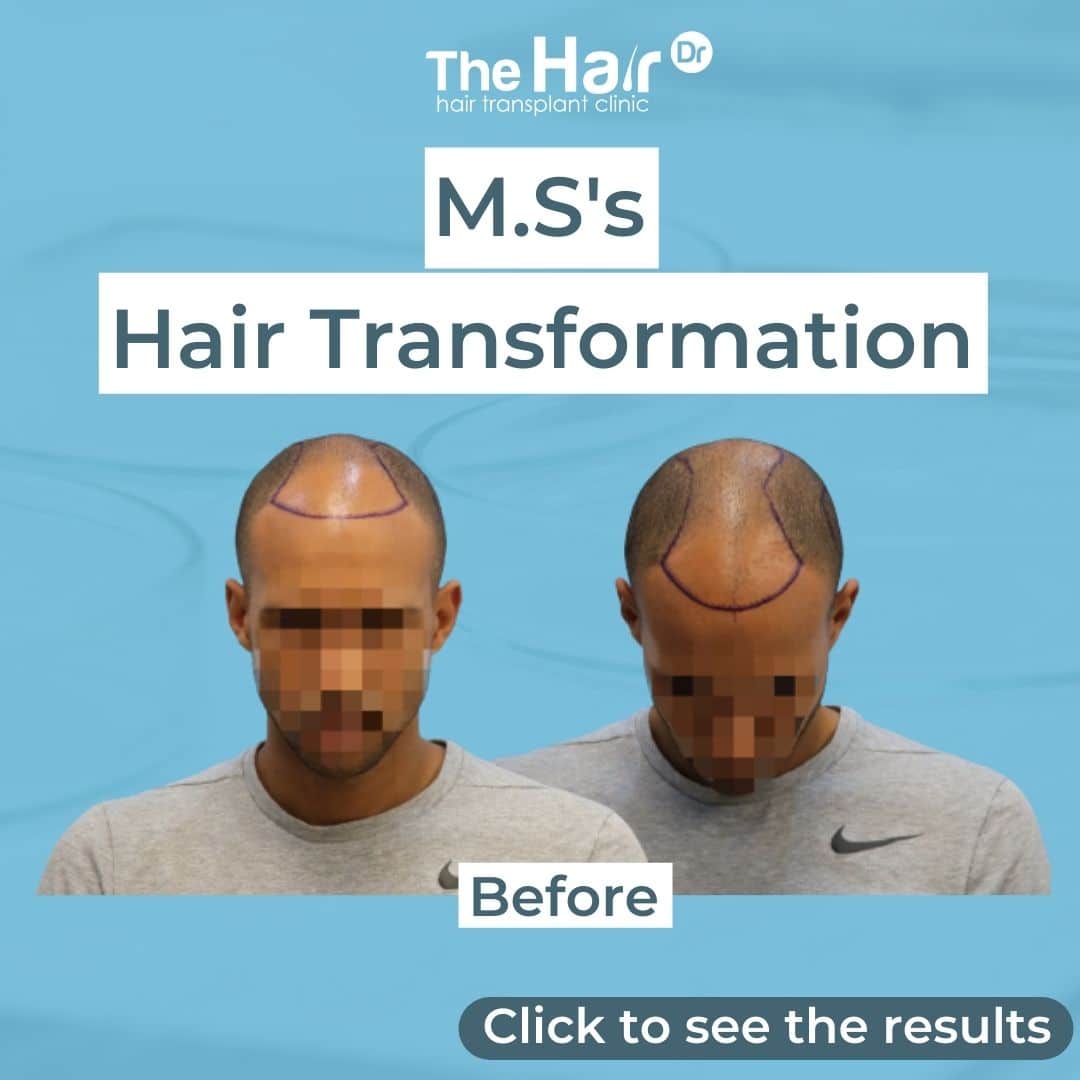 Patient transformation slide 1