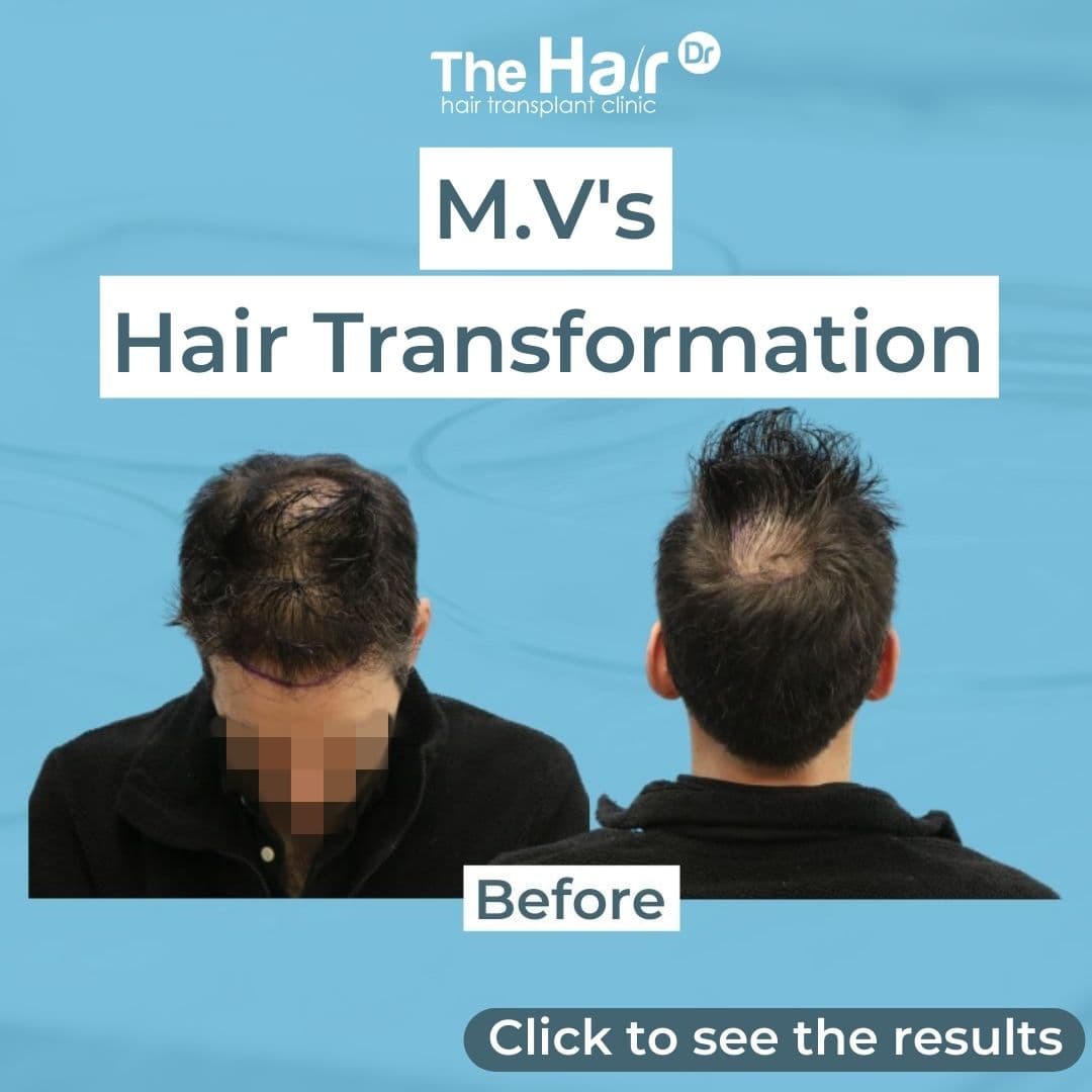 Patient transformation slide 1