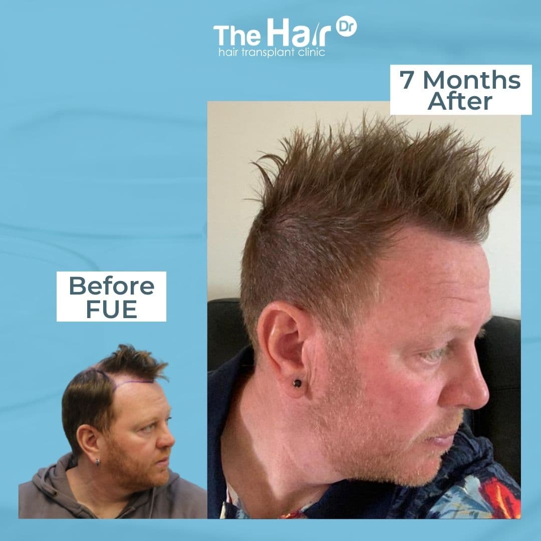 Patient transformation slide 5