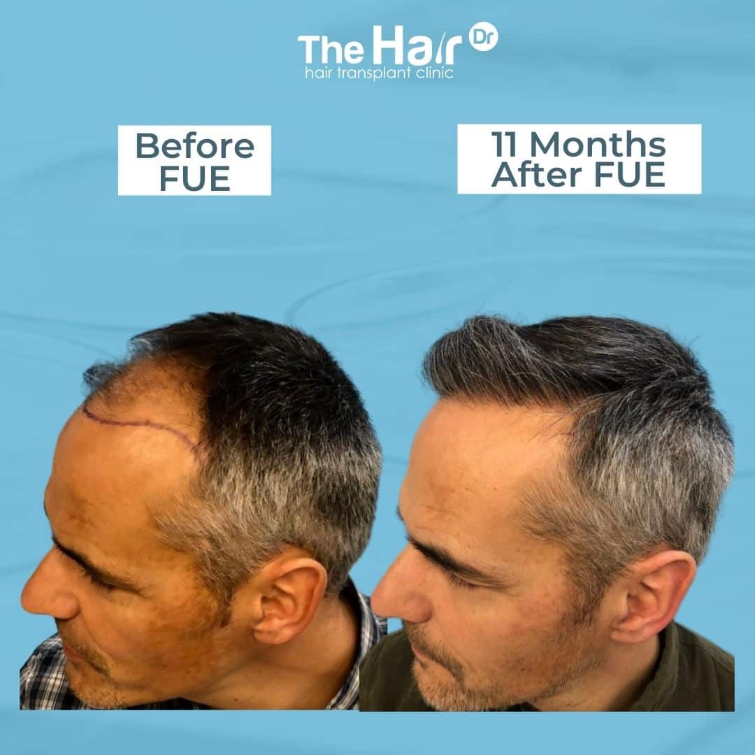 Patient transformation slide 3
