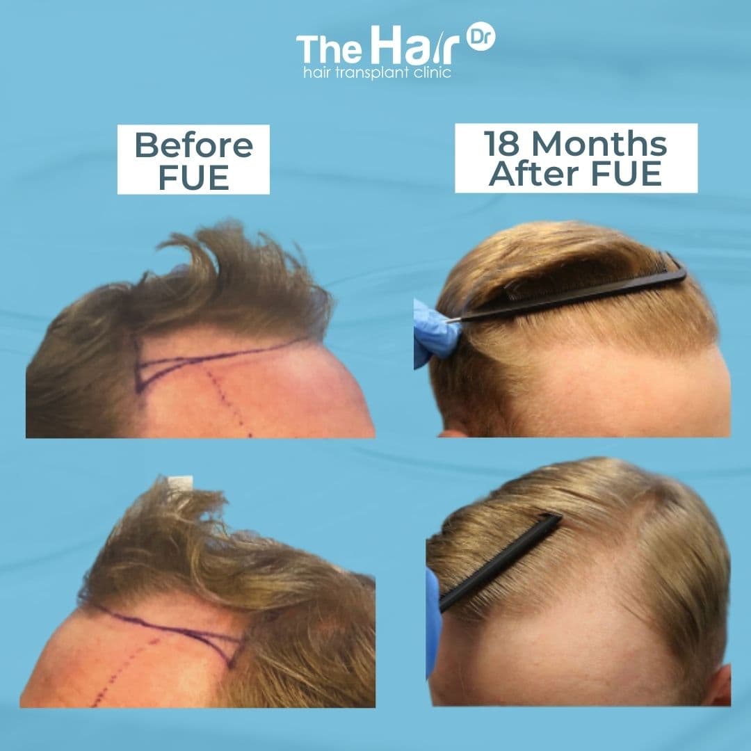 Patient transformation slide 6