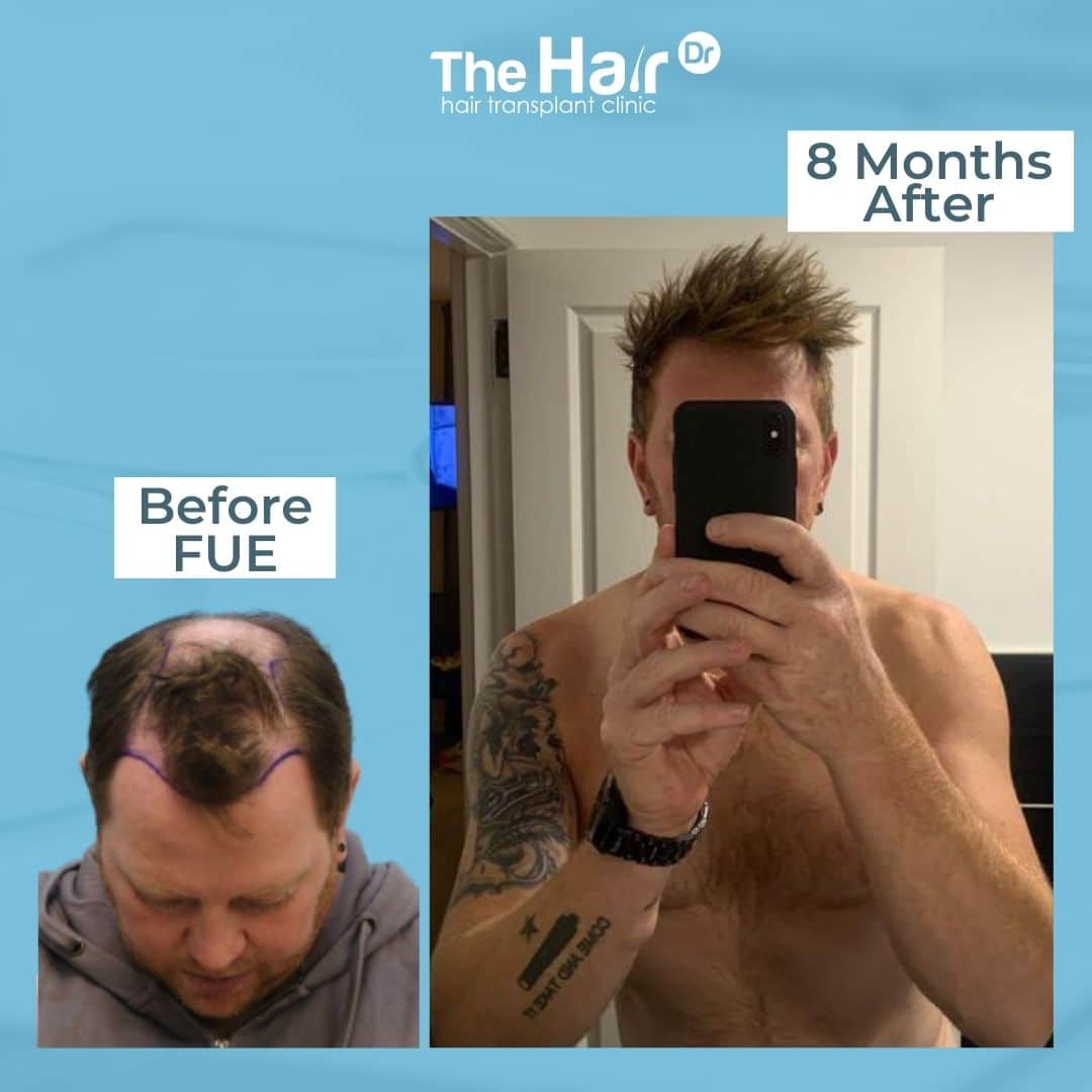 Patient transformation slide 6