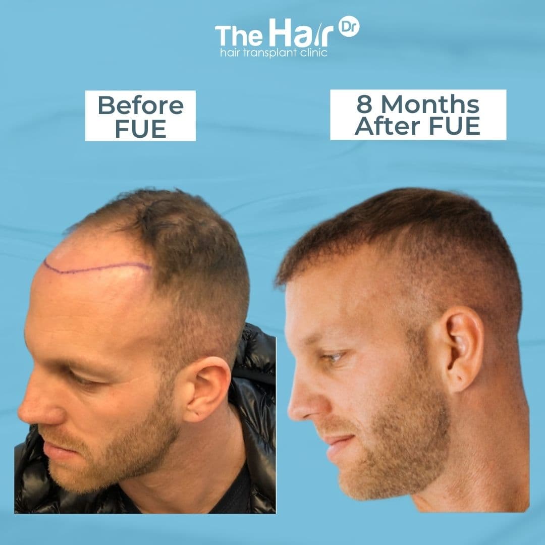 Patient transformation slide 3