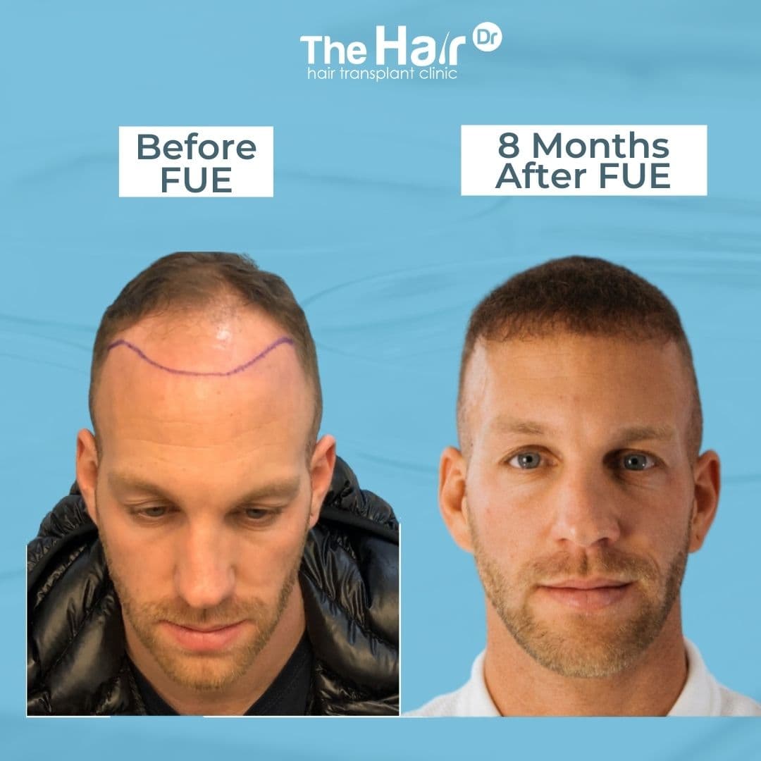 Patient transformation slide 4