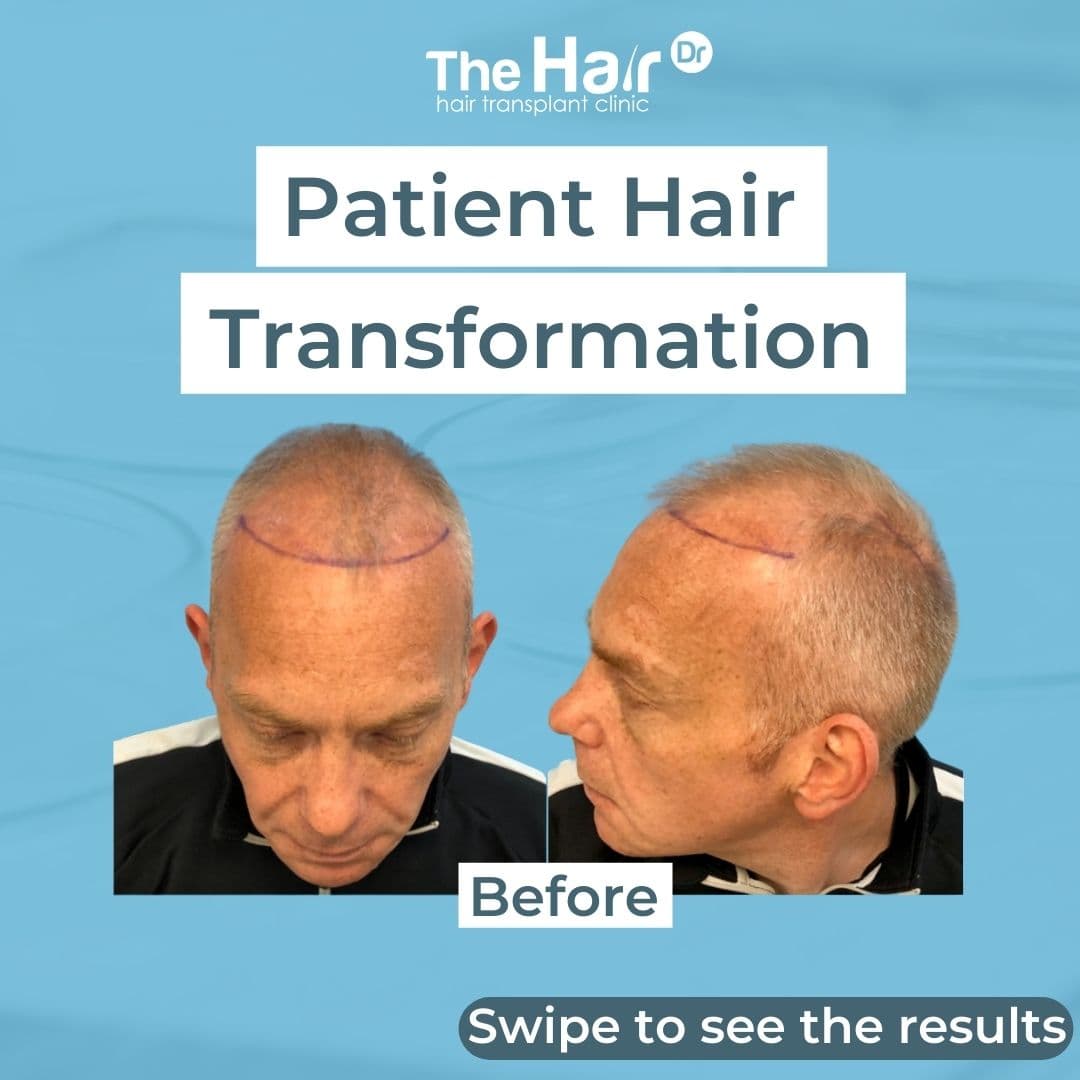 Patient transformation slide 1