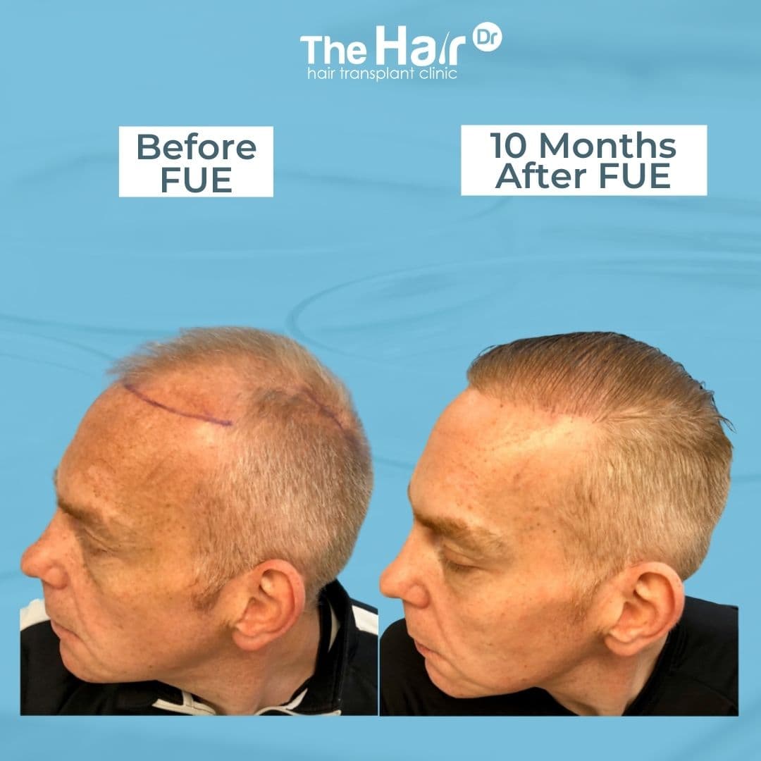 Patient transformation slide 2