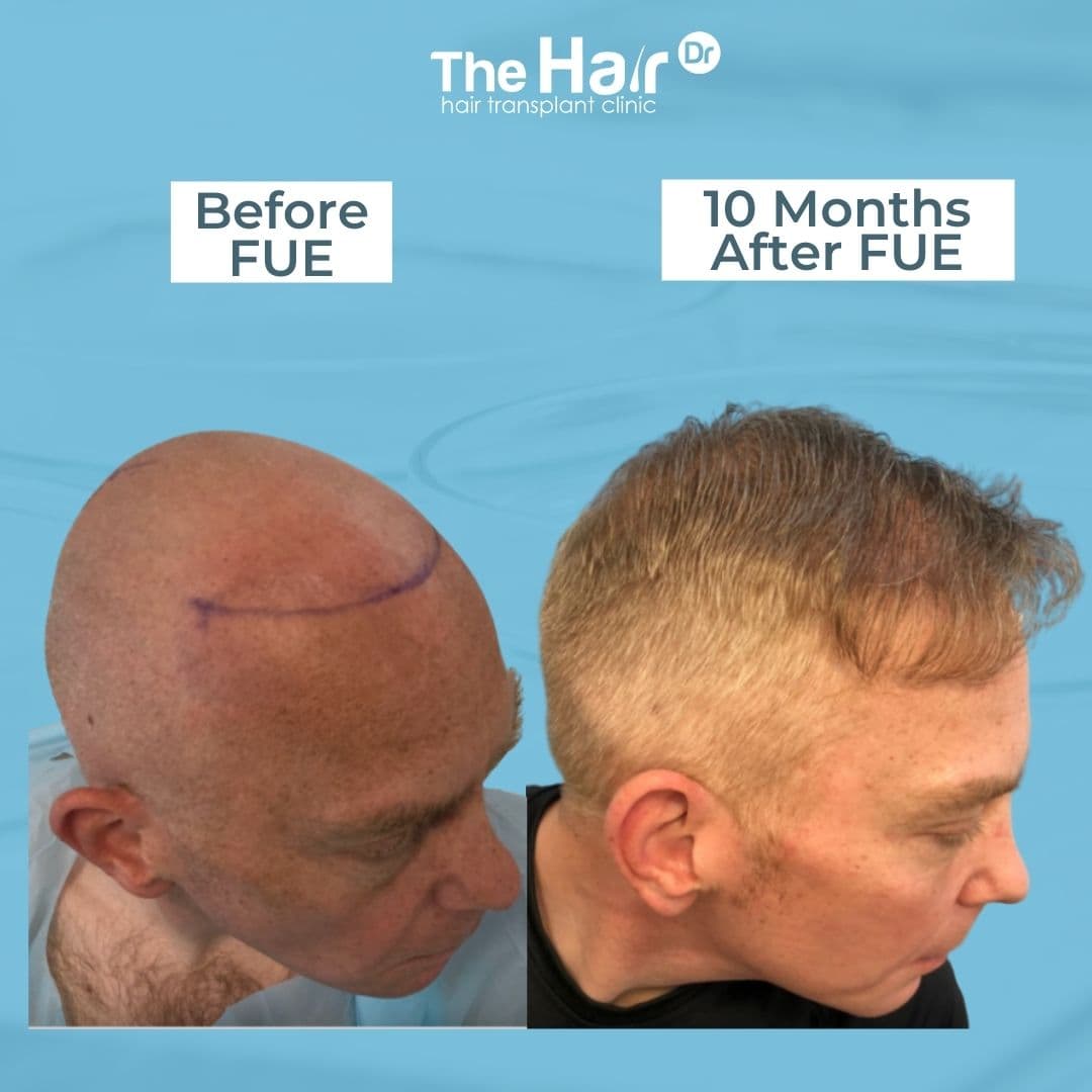 Patient transformation slide 3