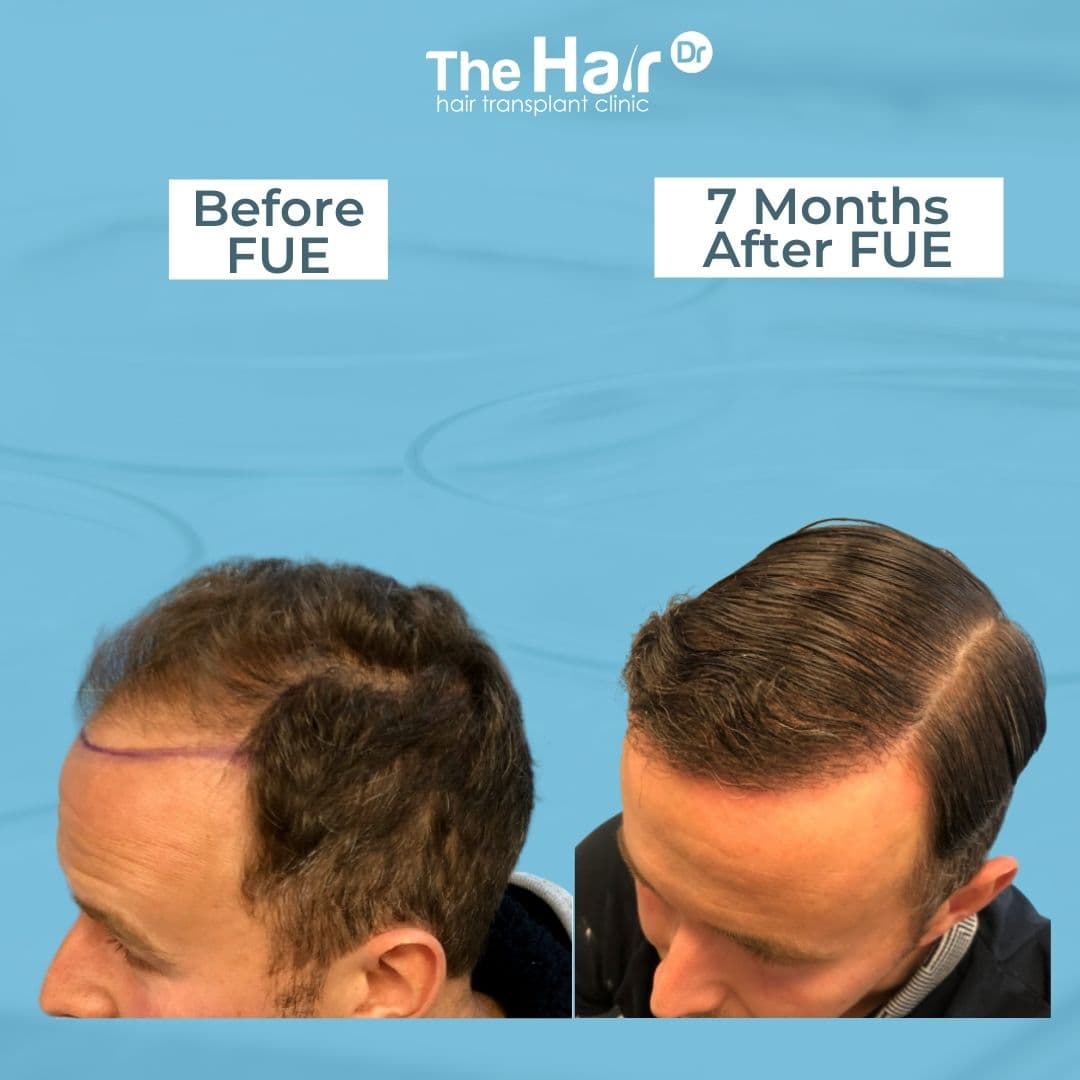 Patient transformation slide 3