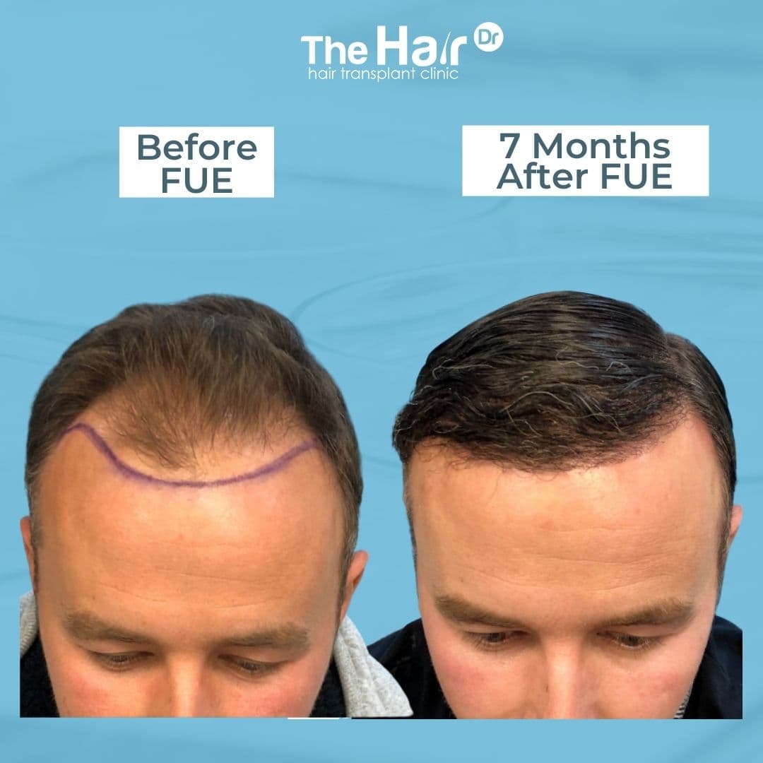 Patient transformation slide 5