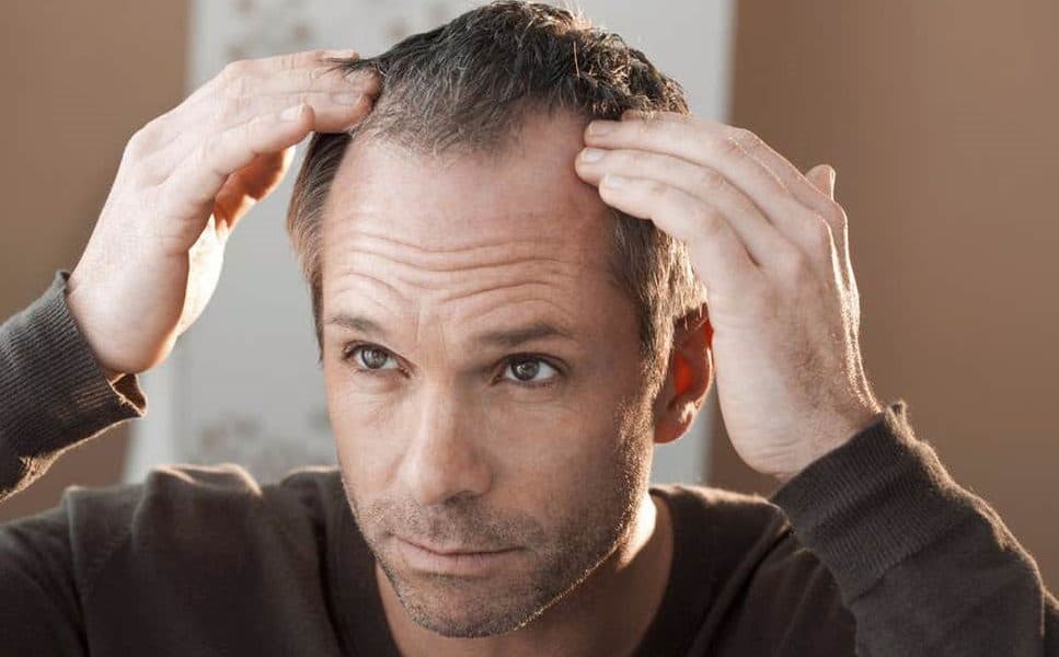 Choosing the right hair transplant procedure