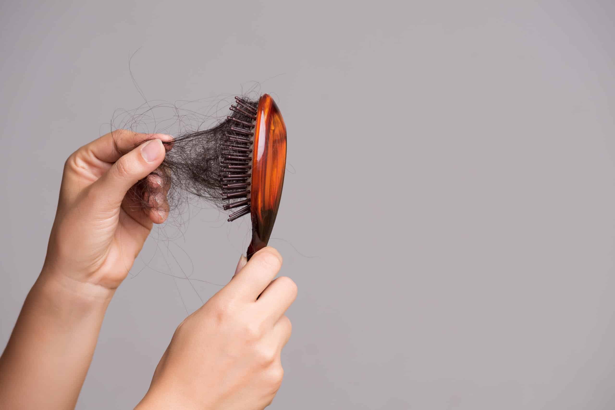 DHI For Women: A Permanent Hair Loss Solution Women Embrace