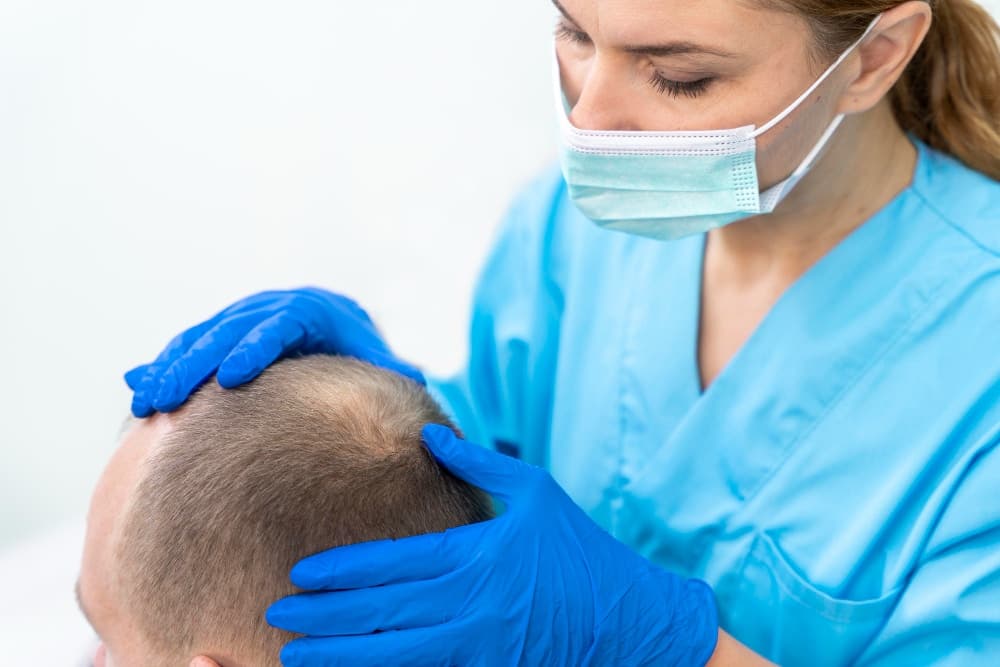Everything You Need to Know Before Getting a Hair Transplant
