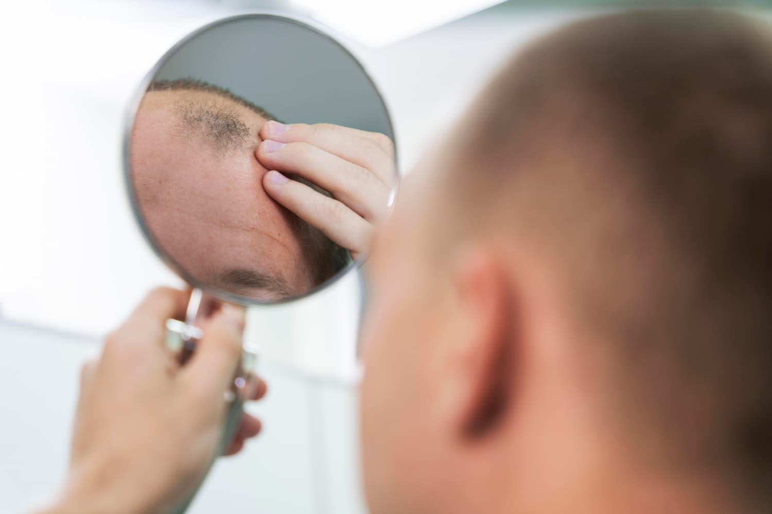 How Does a Hair Transplant Work? An In-Depth Guide