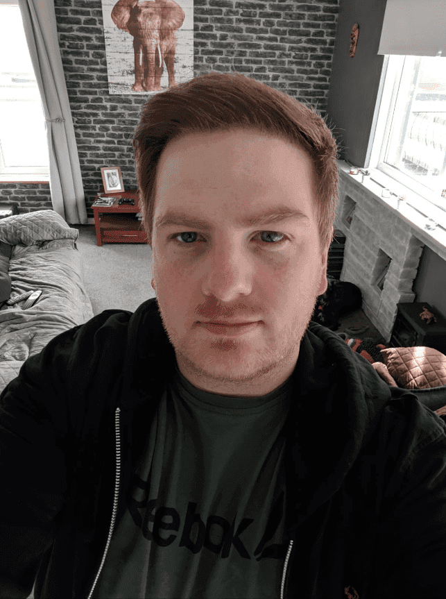 The Sun: Two men talk about the true impact of losing their locks