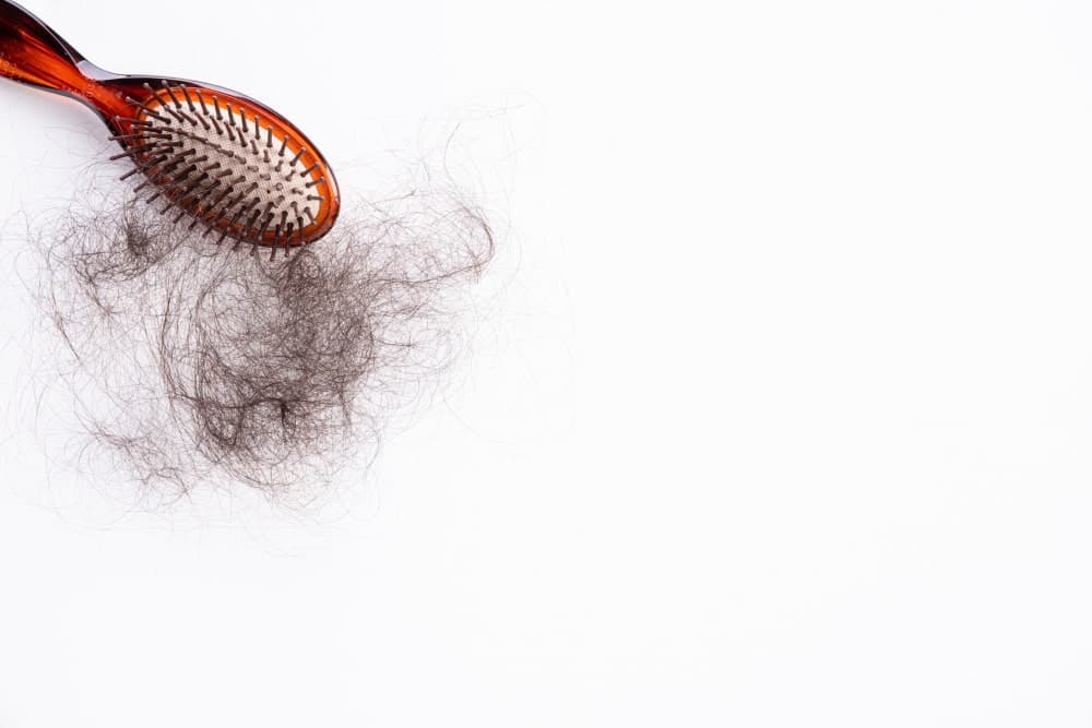 What is the Hair Transplant Shedding Phase?